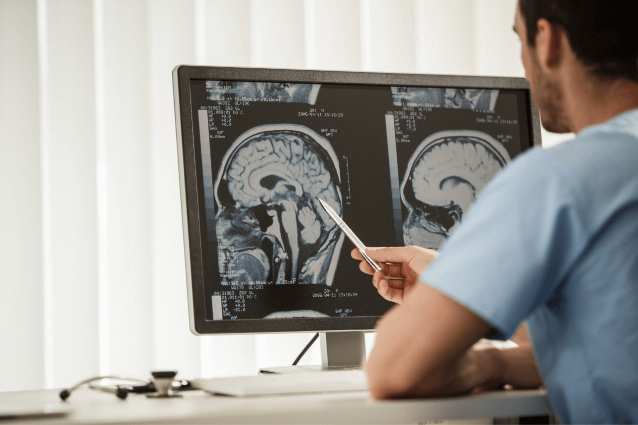 How Does Gamma Knife®️ Treatment for Brain Tumors Work?